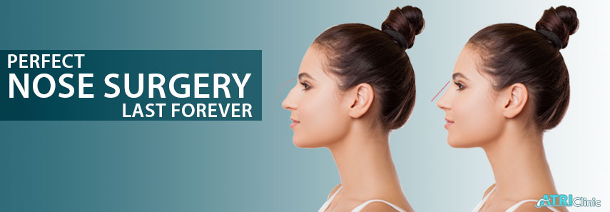 rhinoplasty surgery in kolkata