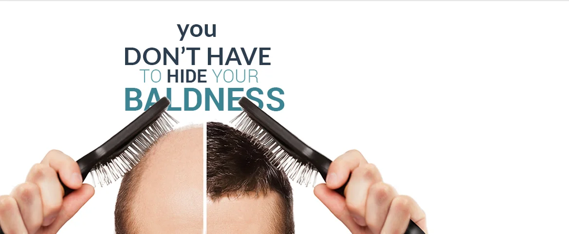 best hair transplant in india